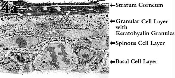 fig4