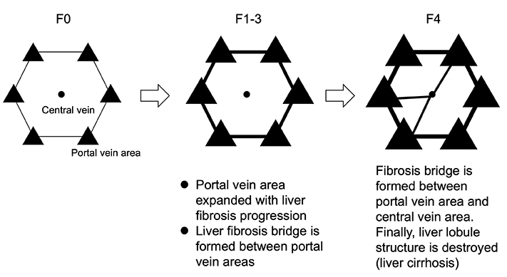 図1B