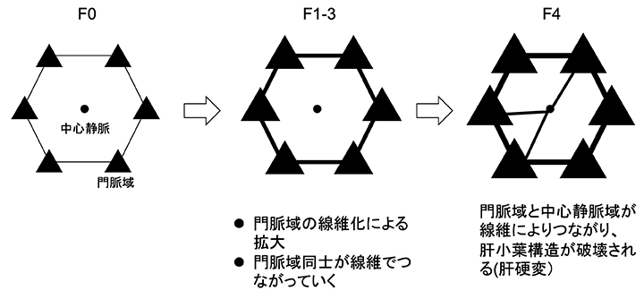 図1B