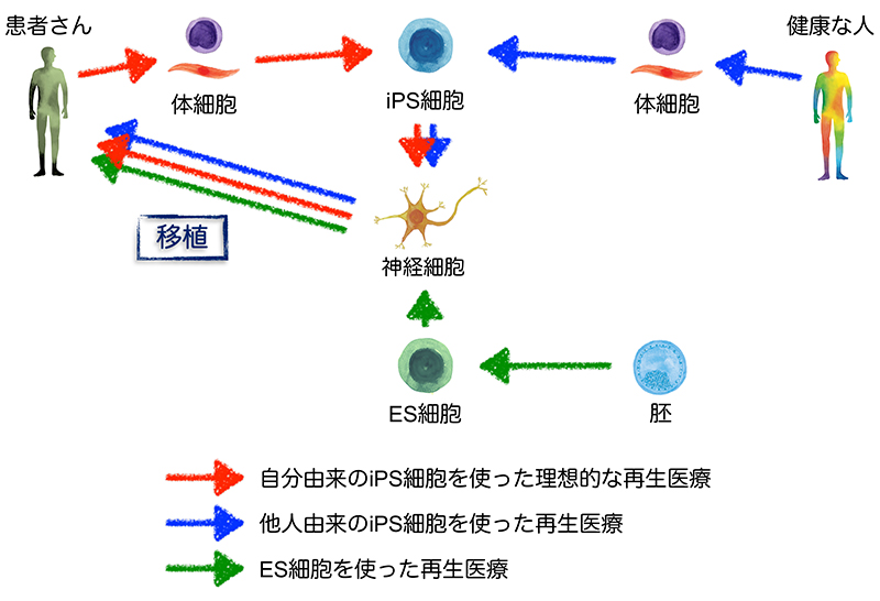 Ips細胞の誕生から医療応用まで